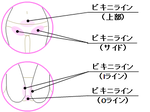 無痛　デリケートゾーン　脱毛